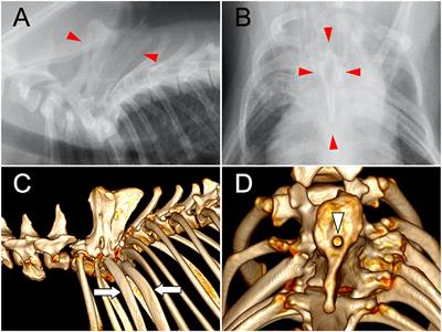 Case Report: Surgical Treatment of Type IV Spinal Dermoid Sinus in a Shiba Inu